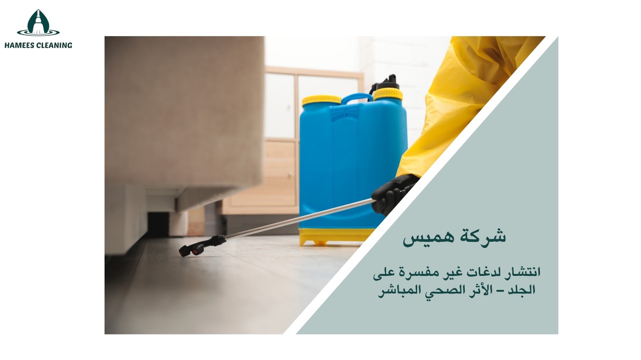 علامات وجود حشرات في المنزل